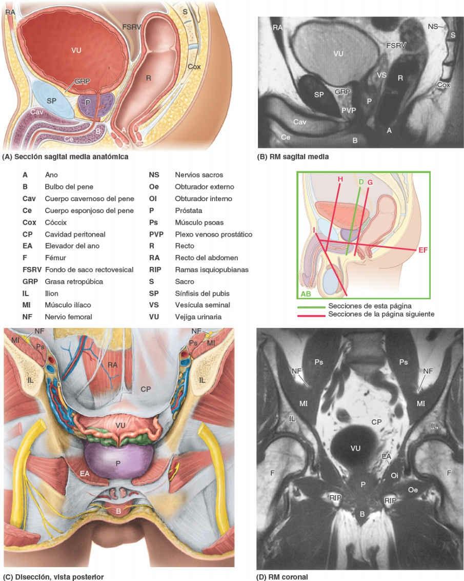 Fig. 6-72-bis
