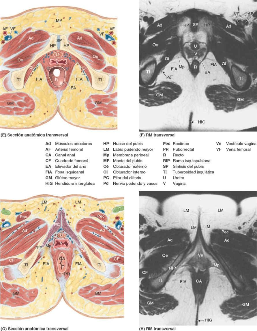 Fig. 6-73-bis